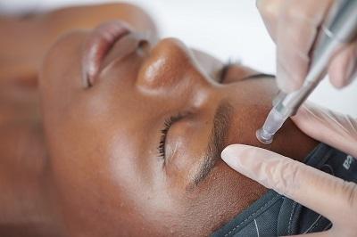 Microneedling